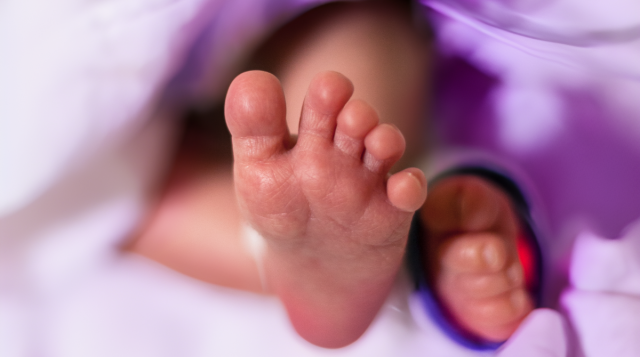 Prematurità