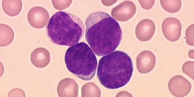 Leucemia